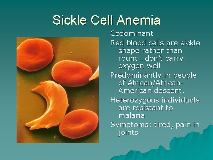 Sickle Cell Anemia Codominant Red blood cells are sickle shape rather than round…don’t carry