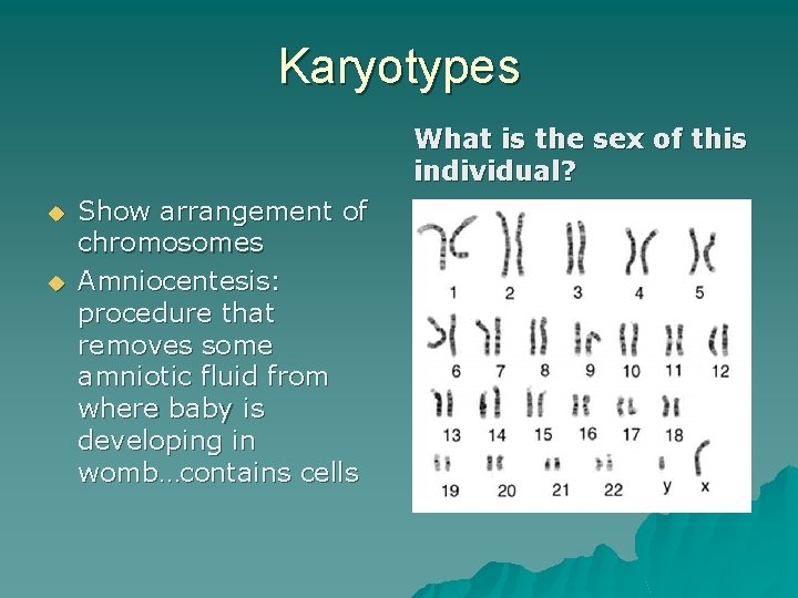 Karyotypes What is the sex of this individual? u u Show arrangement of chromosomes