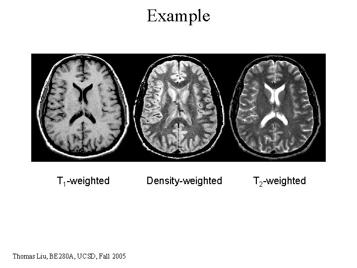 Example T 1 -weighted Thomas Liu, BE 280 A, UCSD, Fall 2005 Density-weighted T