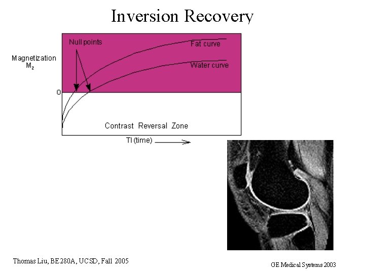 Inversion Recovery Thomas Liu, BE 280 A, UCSD, Fall 2005 GE Medical Systems 2003
