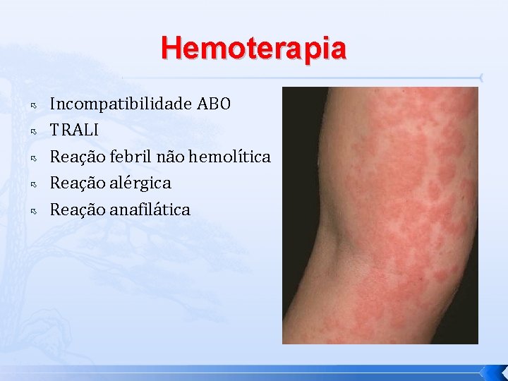 Hemoterapia Incompatibilidade ABO TRALI Reação febril não hemolítica Reação alérgica Reação anafilática 