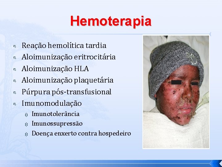 Hemoterapia Reação hemolítica tardia Aloimunização eritrocitária Aloimunização HLA Aloimunização plaquetária Púrpura pós-transfusional Imunomodulação Imunotolerância