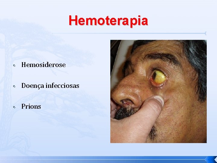 Hemoterapia Hemosiderose Doença infecciosas Prions 