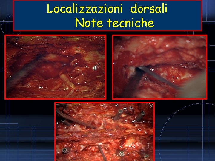 Localizzazioni dorsali Note tecniche 
