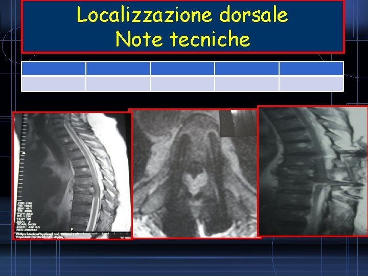 Localizzazione dorsale Note tecniche 