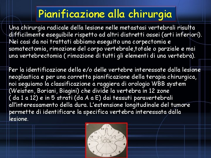 Pianificazione alla chirurgia Una chirurgia radicale della lesione nelle metastasi vertebrali risulta difficilmente eseguibile