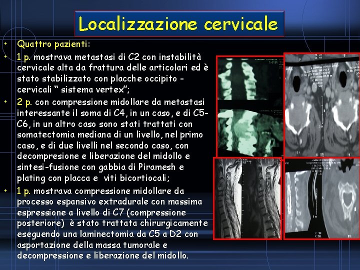 Localizzazione cervicale • • Quattro pazienti: 1 p. mostrava metastasi di C 2 con