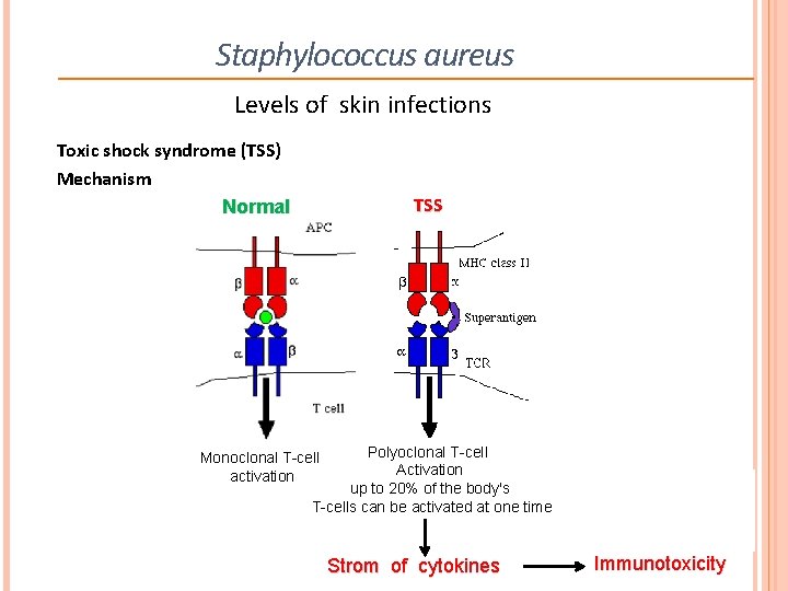Staphylococcus aureus Levels of skin infections Toxic shock syndrome (TSS) Mechanism Normal TSS Polyoclonal Staphylococcus aureus Levels of skin infections Toxic shock syndrome (TSS) Mechanism Normal TSS Polyoclonal