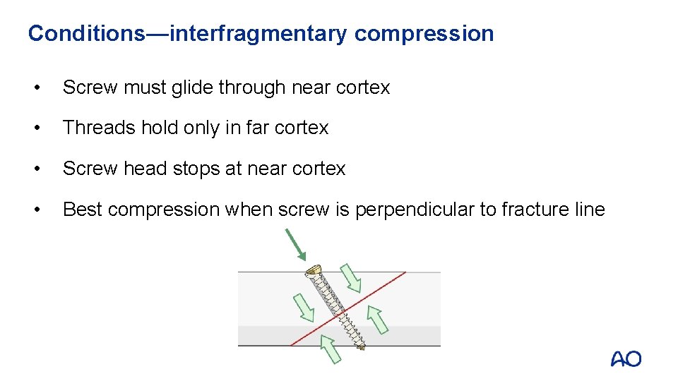 Conditions—interfragmentary compression • Screw must glide through near cortex • Threads hold only in
