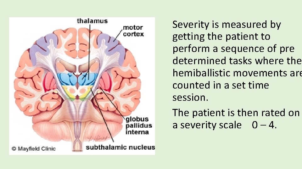 Severity is measured by getting the patient to perform a sequence of pre determined