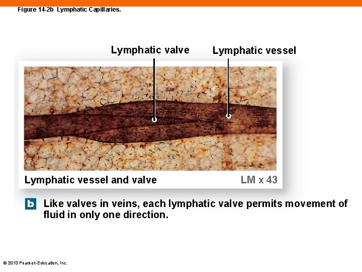 Figure 14 -2 b Lymphatic Capillaries. Lymphatic valve Lymphatic vessel and valve Lymphatic vessel