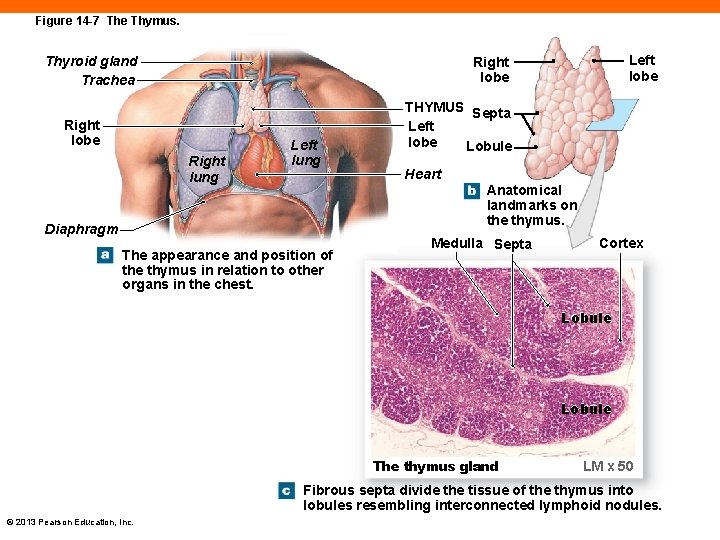 Figure 14 -7 The Thymus. Thyroid gland Trachea Left lobe Right lung Left lung