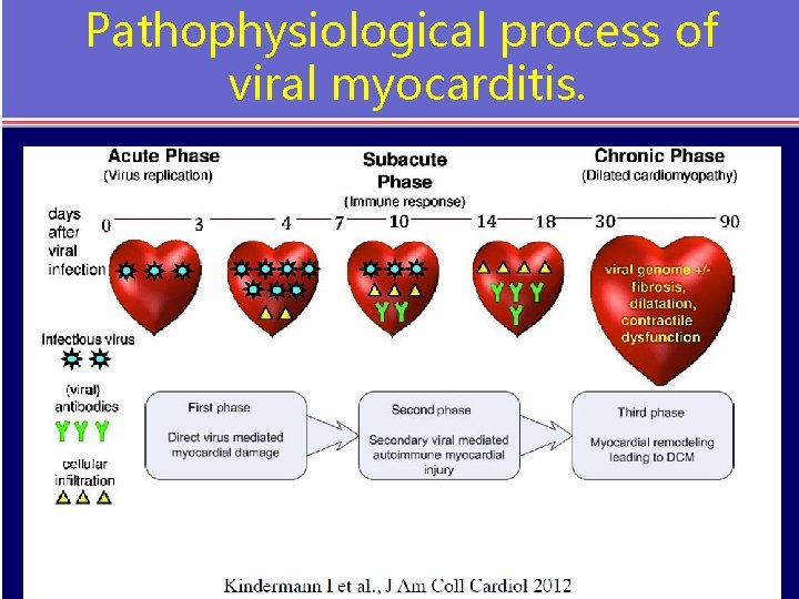 Pathophysiological process of viral myocarditis. 