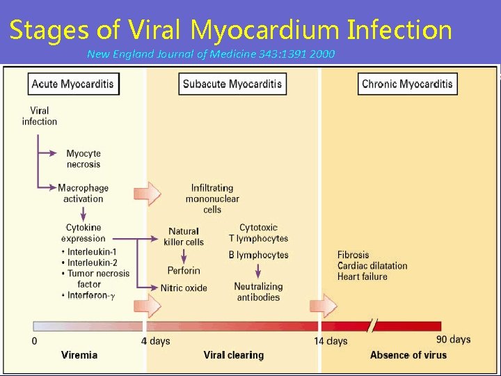 Stages of Viral Myocardium Infection New England Journal of Medicine 343: 1391 2000 