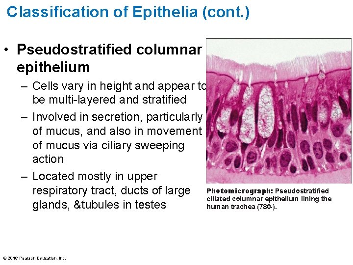 Classification of Epithelia (cont. ) • Pseudostratified columnar epithelium – Cells vary in height