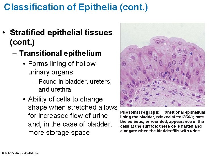 Classification of Epithelia (cont. ) • Stratified epithelial tissues (cont. ) – Transitional epithelium