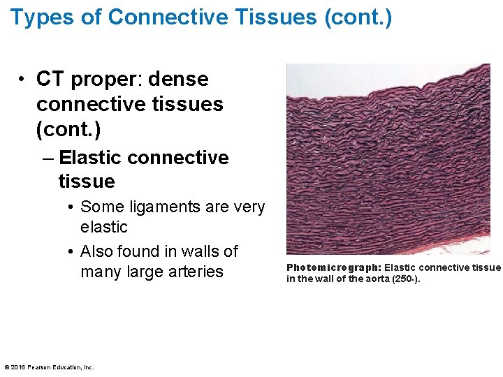Types of Connective Tissues (cont. ) • CT proper: dense connective tissues (cont. )