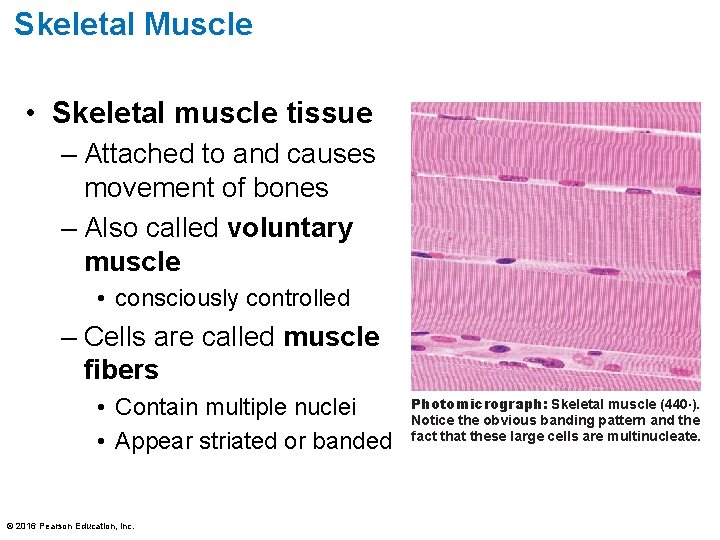 Skeletal Muscle • Skeletal muscle tissue – Attached to and causes movement of bones