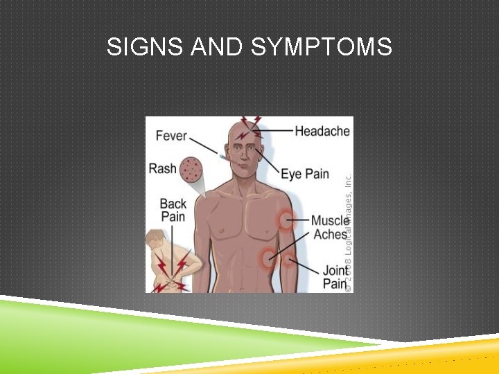 SIGNS AND SYMPTOMS SIGNS AND SYMPTOMS