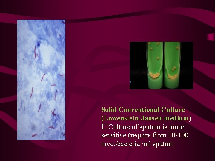 Solid Conventional Culture (Lowenstein-Jansen medium) �Culture of sputum is more sensitive (require from 10