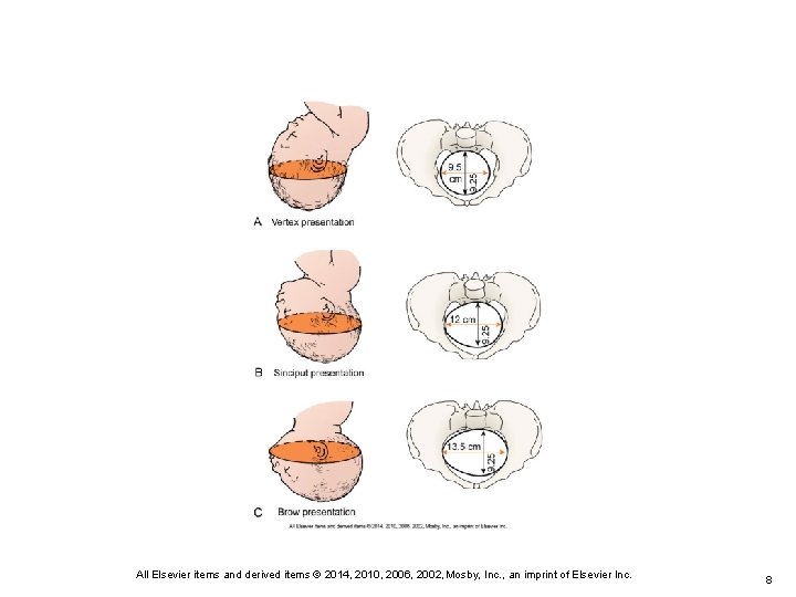 All Elsevier items and derived items © 2014, 2010, 2006, 2002, Mosby, Inc. ,