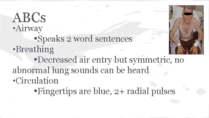 ABCs • Airway Speaks 2 word sentences • Breathing Decreased air entry but symmetric,