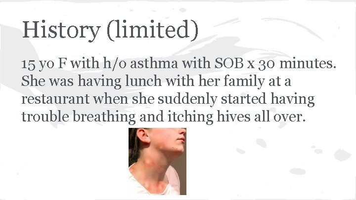 History (limited) 15 yo F with h/o asthma with SOB x 30 minutes. She