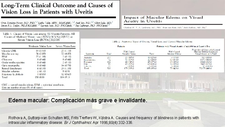 Edema macular: Complicación más grave e invalidante. Rothova A, Suttorp-van Schulten MS, Frits Treffers