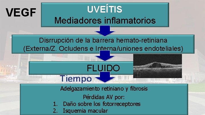 VEGF UVEÍTIS Mediadores inflamatorios Disrrupción de la barrera hemato-retiniana (Externa/Z. Ocludens e Interna/uniones endoteliales)