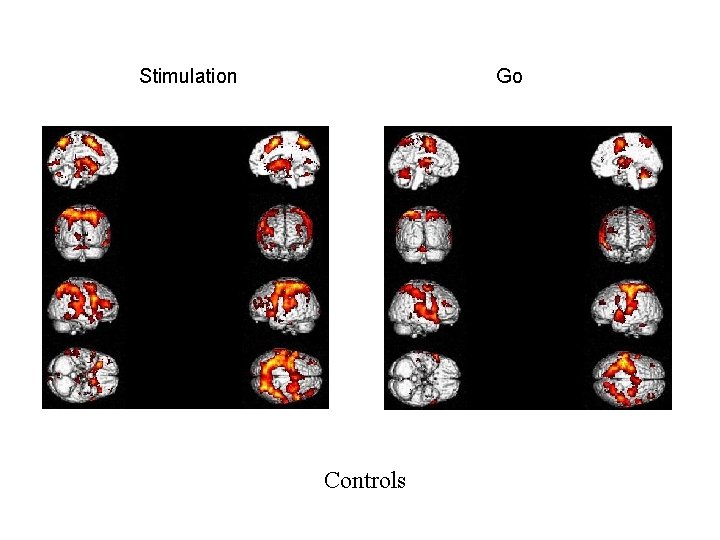 Stimulation Go Controls 