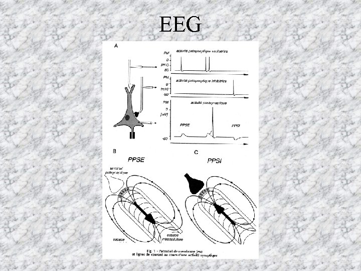 EEG 