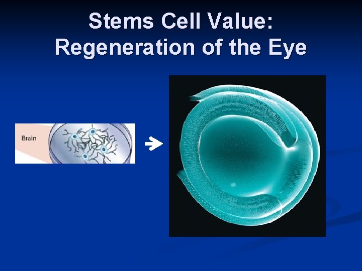 Stems Cell Value: Regeneration of the Eye 