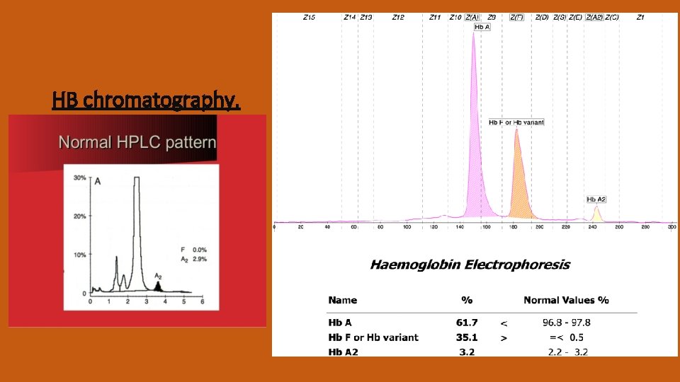 Structure of Haemoglobin THALASSEMIA It result from reduced
