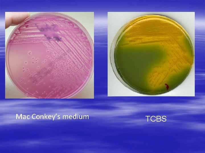 Mac Conkey’s medium TCBS 