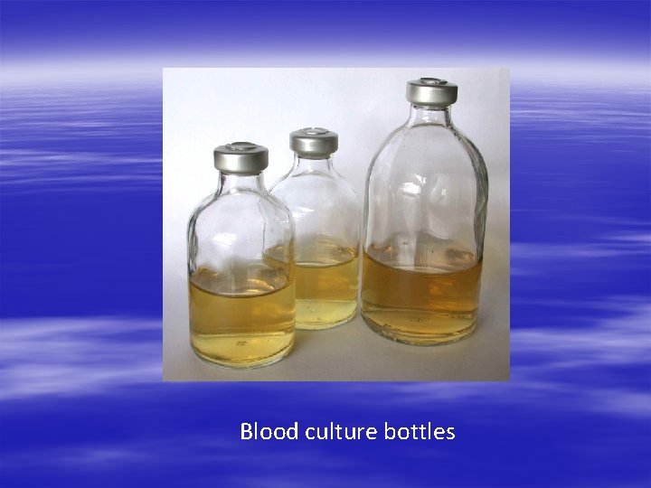 Blood culture bottles 