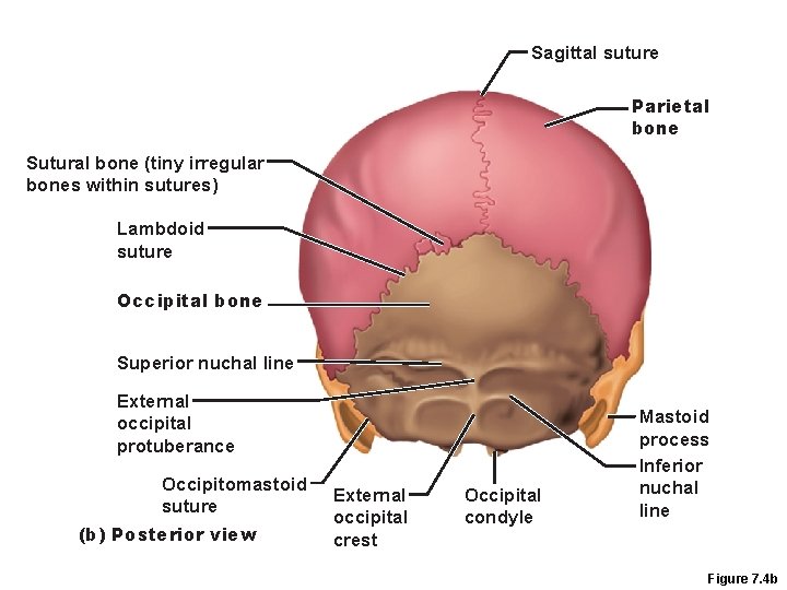 Sagittal suture Parietal bone Sutural bone (tiny irregular bones within sutures) Lambdoid suture Occipital