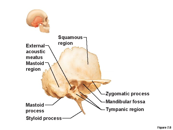 External acoustic meatus Mastoid region Squamous region Zygomatic process Mastoid process Mandibular fossa Tympanic