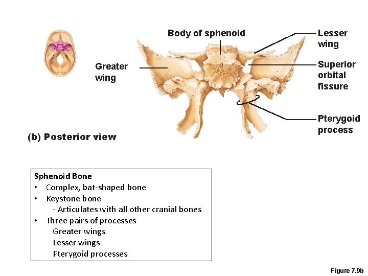 Body of sphenoid Greater wing (b) Posterior view Lesser wing Superior orbital fissure Pterygoid