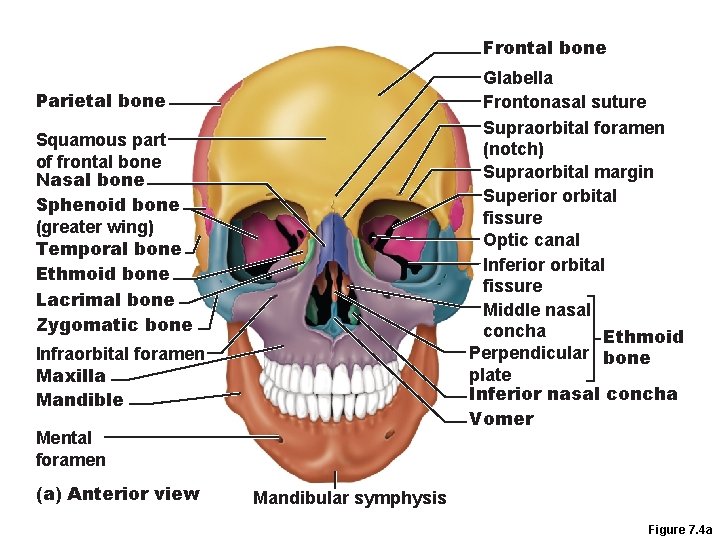 Frontal bone Glabella Frontonasal suture Supraorbital foramen (notch) Supraorbital margin Superior orbital fissure Optic