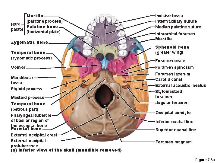 Maxilla (palatine process) Hard Palatine bone palate (horizontal plate) Zygomatic bone Temporal bone (zygomatic