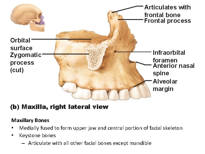 Articulates with frontal bone Frontal process Orbital surface Zygomatic process (cut) Infraorbital foramen Anterior