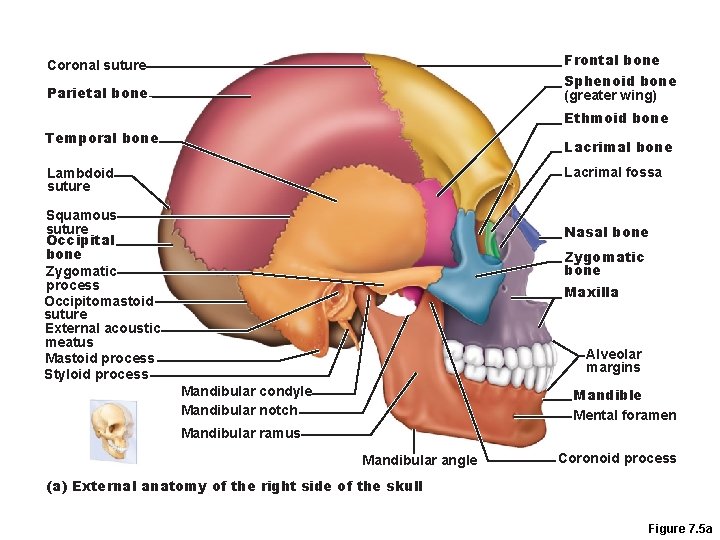 Frontal bone Sphenoid bone (greater wing) Coronal suture Parietal bone Ethmoid bone Temporal bone