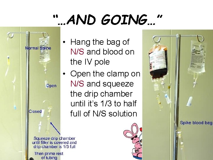 “…AND GOING…” • Hang the bag of N/S and blood on the IV pole