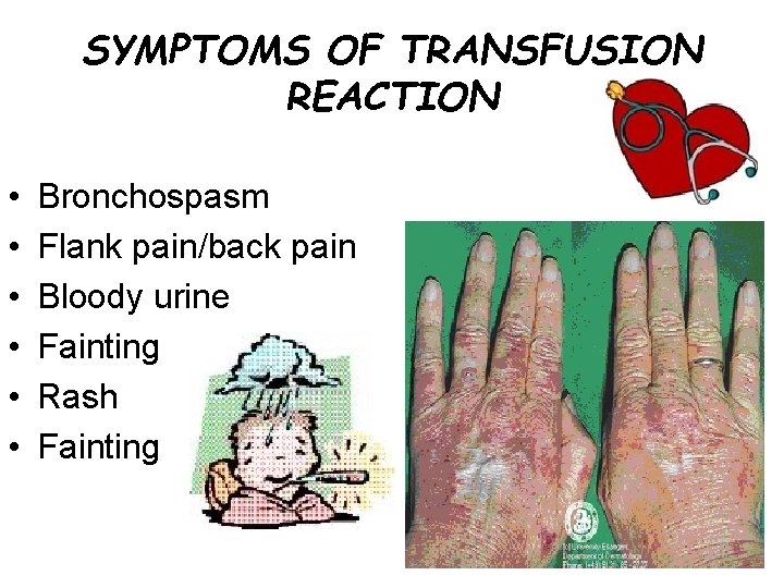 SYMPTOMS OF TRANSFUSION REACTION • • • Bronchospasm Flank pain/back pain Bloody urine Fainting