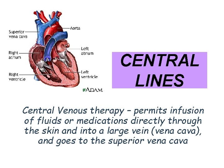 CENTRAL LINES Central Venous therapy – permits infusion of fluids or medications directly through