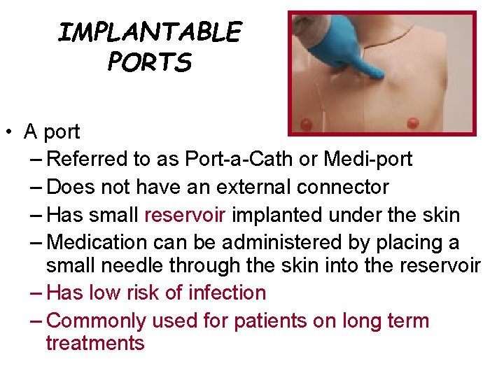 IMPLANTABLE PORTS • A port – Referred to as Port-a-Cath or Medi-port – Does