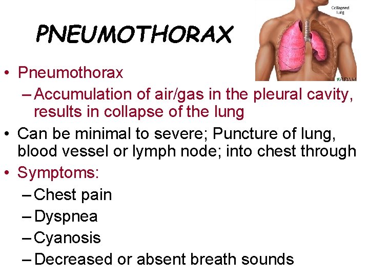 PNEUMOTHORAX • Pneumothorax – Accumulation of air/gas in the pleural cavity, results in collapse