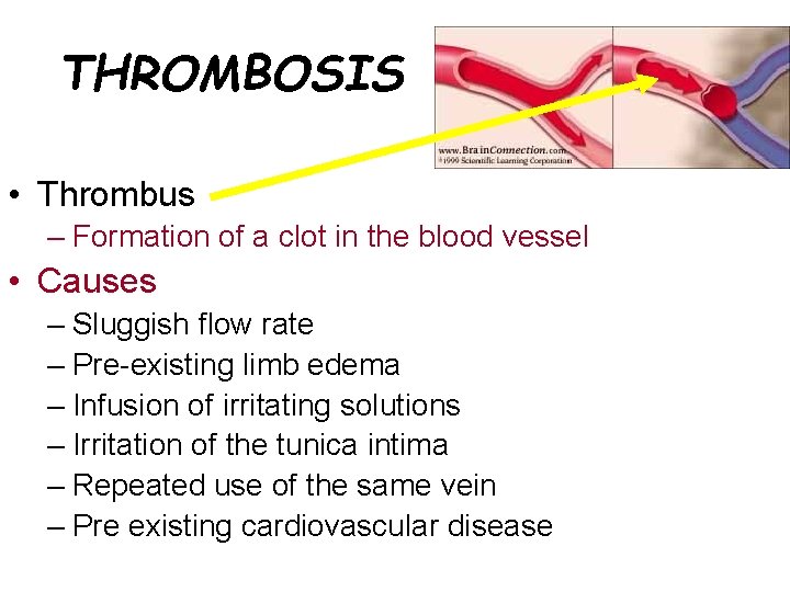 THROMBOSIS • Thrombus – Formation of a clot in the blood vessel • Causes