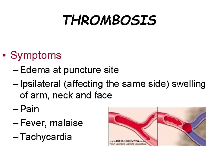 THROMBOSIS • Symptoms – Edema at puncture site – Ipsilateral (affecting the same side)