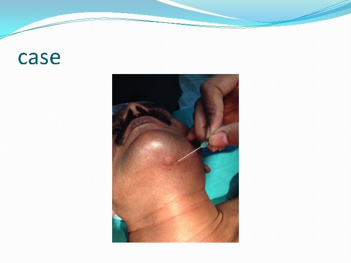 case 